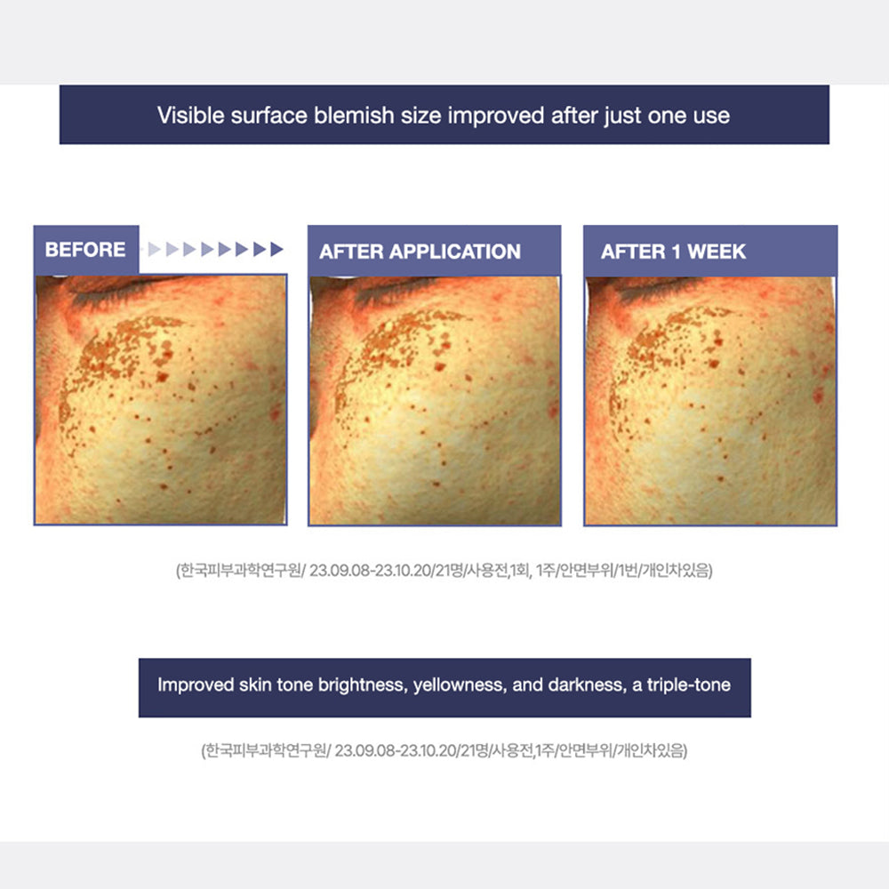Centellian 24 Expert Madeca Cream Radiance | Korean Skincare Centella Asiatica image 2